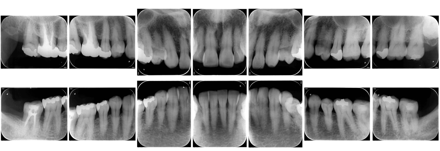 ③レントゲン検査