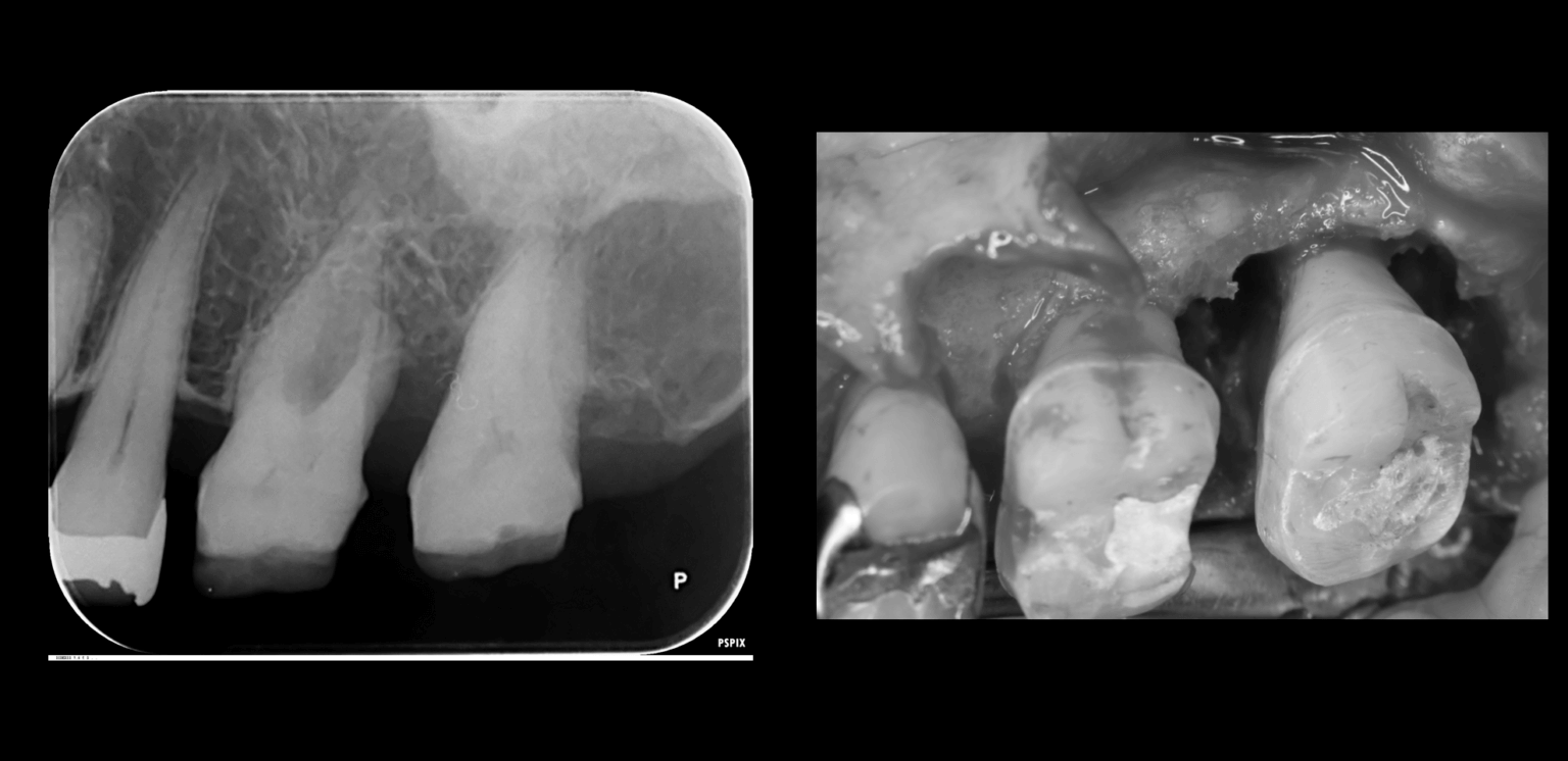 患者さんの経過
