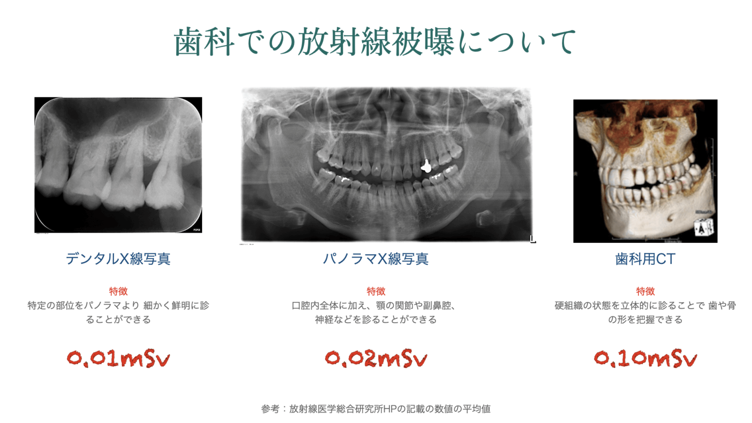 レントゲン撮影の安全性